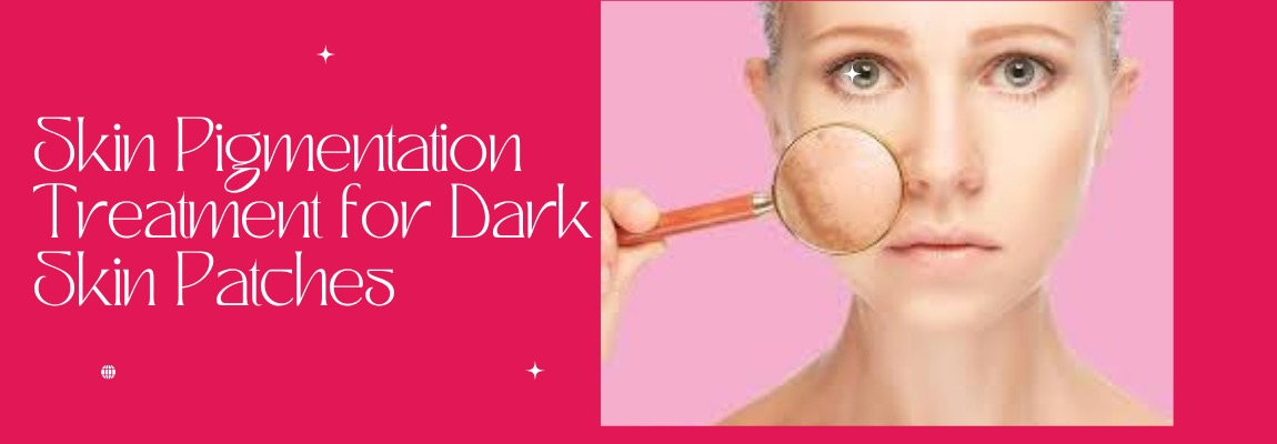 Skin Pigmentation Treatment in delhi